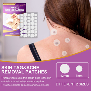 ELAIMEI Custom Logo <strong>Skin</strong> <strong>Tag</strong> <strong>Remover</strong> <strong>Patches</strong> 144pcs OEM Service Natural Herbal Acne &amp; Wart Removal Pain Free Fast Acting Factory - Product Image 3
