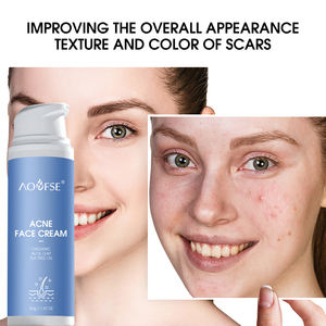 Crema para el acné más vendida, ingrediente de hierbas orgánicas, crema para espinillas de <span class=keywords><strong>piel</strong></span> suave e iluminadora para <span class=keywords><strong>piel</strong></span> grasa - Product Image 3