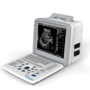 Équipement d'échographie médicale BW300, système d'échographie numérique complet - Product Image 1