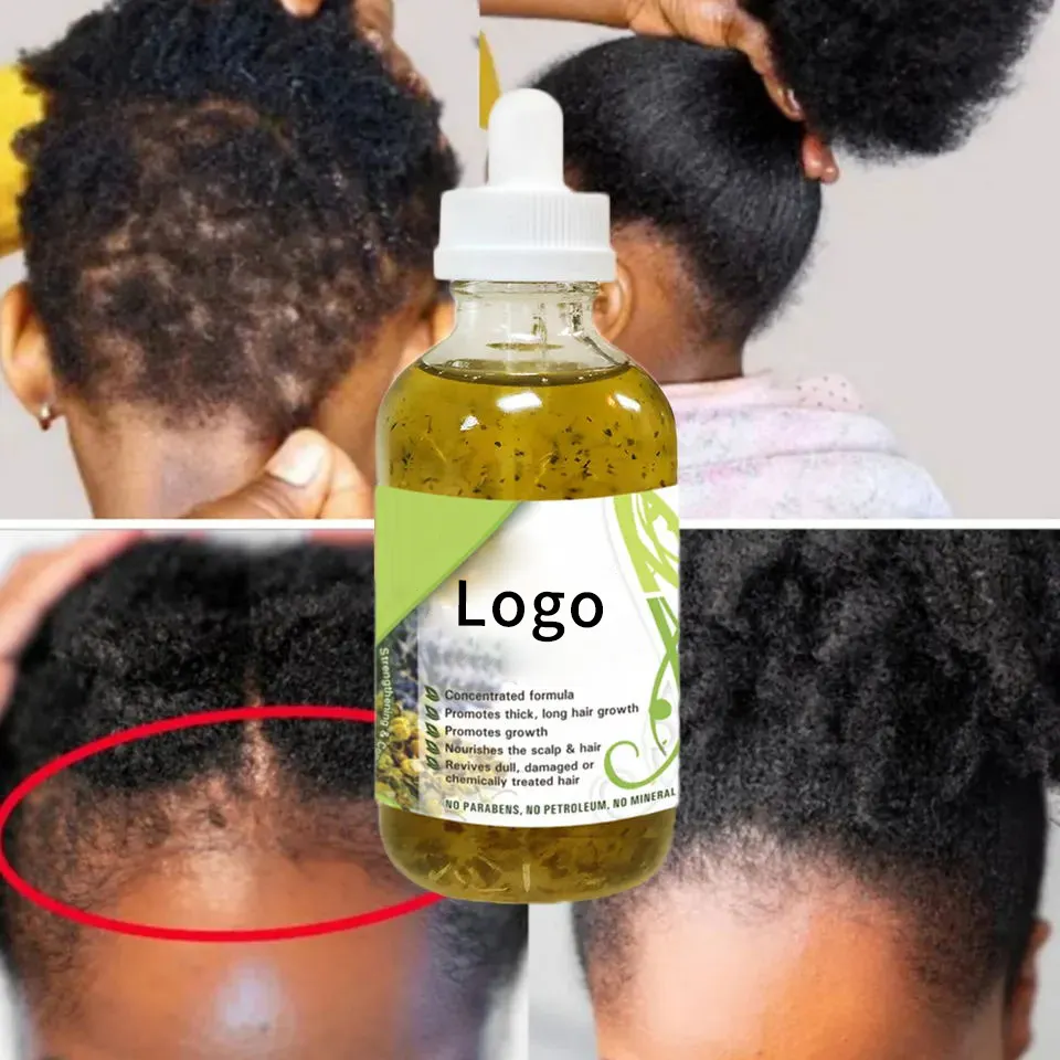 Botellas OEM/ODM para hombres con etiqueta personalizada Aceite para el crecimiento del cabello Secretos de África Oriental