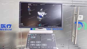 Échographe portable Mindray Consona N5S avec fonctions TDI et CW, échographe 3D 4D 5D Mindray adapté aux services publics - Product Image 5