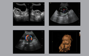Sonoscape S9 Pro dengan Sonoscape Linear Probe <span class=keywords><strong>Echocardiography</strong></span> Ultrasound Machine - Product Image 6