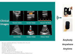Xách tay không dây siêu âm thiết bị cầm tay Wifi và kết nối USB siêu âm DOPPLER màu siêu âm đầu dò cho điện thoại và máy tính bảng - Product Image 6