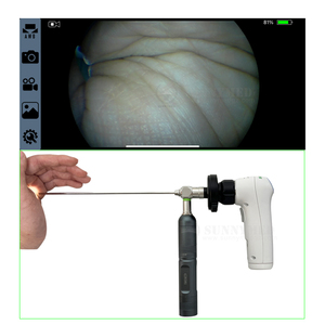 SY-P052 1080p Portable ORL <span class=keywords><strong>endoscope</strong></span> caméra système ent <span class=keywords><strong>endoscope</strong></span> caméra module médical HD sans fil endoscopique caméra - Product Image 5