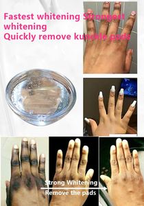 Suero Aclarante Rápido para Nudillos Oscuros, Corrector de Pigmentación, Eliminador de Manchas <span class=keywords><strong>en</strong></span> Manos, Codos y Rodillas para Piel <span class=keywords><strong>Negra</strong></span>, Esencia Facial con Niacinamida - Product Image 2