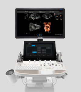 Système d'échographie Doppler couleur Sonoscape P60 sur chariot, élastographie haute définition multi-usages pour la médecine vétérinaire - Product Image 3