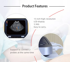 Échographe vétérinaire portable Periodmed avec écran LED de 15 pouces, batterie intégrée et stockage de 500 Go, garantie de 5 ans, VL152B Periodmed - Product Image 5