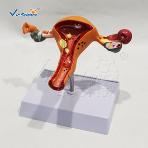 Modelo patológico uterino femenino, modelo anatómico de órgano reproductor ginecológico, molde para enseñanza y formación médica. - Product Image 1