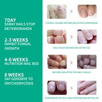 Essence de traitement de haute qualité, solution de réparation des ongles, sérum de réparation des ongles, vernis à ongles