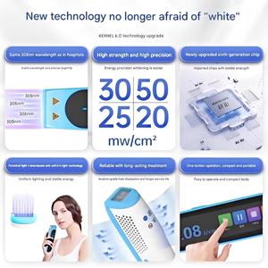 แท่ง308บำบัดด้วยแสงแบบมือถือใหม่การรักษาตามเป้าหมายอุปกรณ์รักษาโรคด่างขาวในบ้านแบบพกพา - Product Image 5