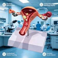 Modèle de Pathologie Utérine pour l'Enseignement en Gynécologie des Facultés de Médecine et Cliniques d'Obstétrique et Gynécologie Hospitalières, Science Populaire CE/ISO/ROHS