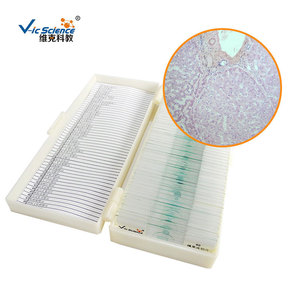 Liver cirrhosis, medical histology, digestive system diseases, biological slides, <b>microscope</b> slides - Product Image 2