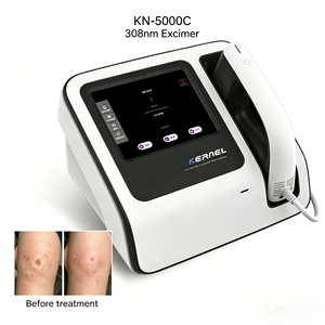 Láser Excimer de Alta Calidad Kernel CE, Láser Excimer de 308 nm para el Tratamiento del Vitiligo - Product Image 1