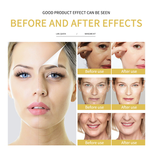 Set de Cuidado de la Piel con Etiqueta Personalizada OEM, Vitamina C, Blanqueador, Reparador, Reafirmante, Limpiador, Crema Facial, Crema para Ojos, <span class=keywords><strong>Serie</strong></span> de Esencias - Product Image 3