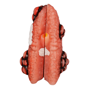 Modèle de poumon fumeur en PVC, taille réelle, comparaison pathologique en coupe transversale, poumon sain vs malade, éducation médicale, santé - Product Image 3