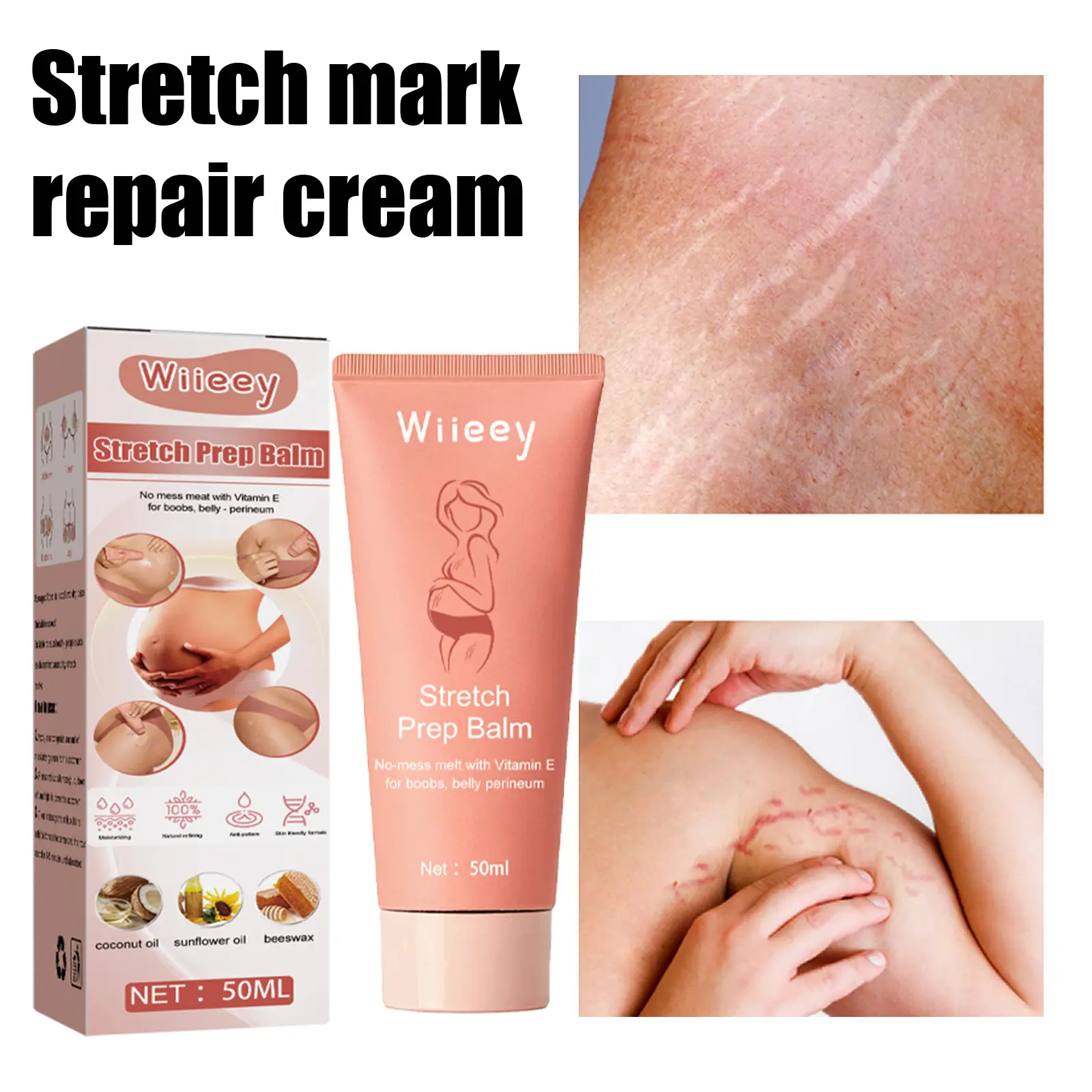 Anti Marks Scar Treatment Stretch Marks Removal Whitening Cream For Pregnancy Repair Stretch Marks Removal Of Pregnancy women