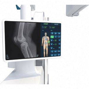 Máquina de Raio-X Digital Móvel 5kW HF 3D <span class=keywords><strong>C</strong></span> <span class=keywords><strong>Arm</strong></span> para Equipamentos de Cirurgia Ortopédica - Product Image 4