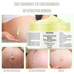 Crème anti-rides et réparatrice pour la peau, marque privée, élimine les vergetures, crème pour les vergetures corporelles, élimine les cicatrices de <span class=keywords><strong>grossesse</strong></span> - Product Image 1