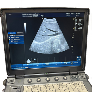 Voorheen Eigendom Van Kleur Doppler Echografie Dierenarts Medische Ultrasonido Apparaatsysteem Draagbare Veterinaire Echografie Machine Scanner - Product Image 4