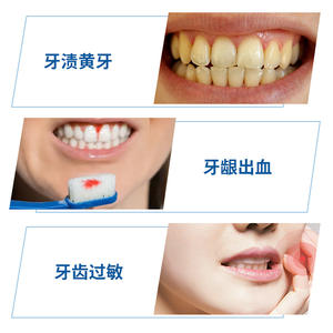 Pâte dentifrice médicale Nanjing Tongrentang 100g pour dents sensibles, dentifrice à base de plantes pour usage domestique - Product Image 1