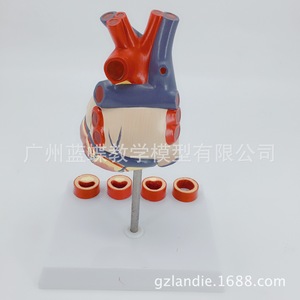 Modèle de cœur humain, modèle de cœur agrandi, modèle d'infarctus, modèle anatomique du cœur. - Product Image 4