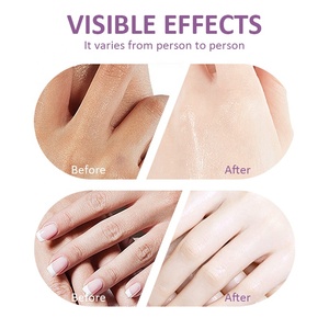 Gants de spa pour les mains à l'huile essentielle de lavande, fabriqués sur mesure, avec glycérine et tréhalose, pour soulager la sécheresse, masque pour les mains confortable - Product Image 6