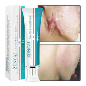 Miglior Gel Organico Efficace per la Rimozione delle Cicatrici con Burro di Karité e Vitamina E per Riparare Acne e Contusioni 30ml - Product Image 5