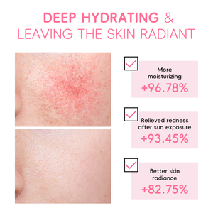LAIKOU JAPAN SAKURA Gel Après-Soleil Hydratant pour le Visage, Crème Gel Éclaircissante avec Glycérine, Lotion Crème - Product Image 5
