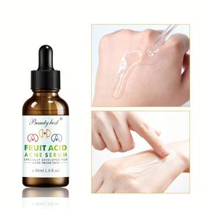 OEM Wholesale Skin Care Anti Acne Serum Effective Mild Fruit Acid Acne Treatment Face Serum 30ML Serum for Acne Skin - Product Image 3