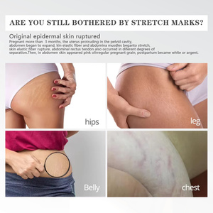 G Striae Verwijderingscrème Body Vermindert Litteken Uiterlijk Zachte Striae Uitroeiing Verstevigende Striae Reparatie Kit - Product Image 4