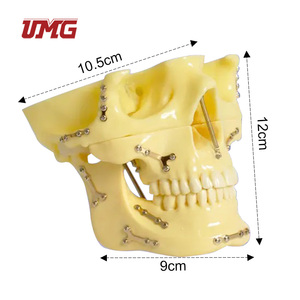 Modèle de <span class=keywords><strong>crâne</strong></span> pour la pratique des implants de fixation de fractures avec plaque en titane prépositionnée pour la formation chirurgicale, l'enseignement et la démonstration - Product Image 2