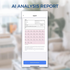 Checkme Bp2 Bluetooth Elektronische Bloeddrukmeter Digitale Bloeddrukmeter Met Ecg Bloeddruk - Product Image 4