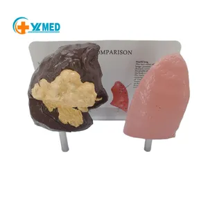 Yulin-modelo de contraste de pulmones, producto en oferta, ciencia médica, modelo de contraste de pulmones saludables y patológicos, maniquí de imagen de 0,35 kg