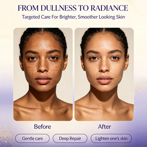 Marque Privée - Soin Naturel Bio Éclaircissant Visage et Corps - Atténue les Taches Brunes et les Taches de Rousseur - Illumine et Corrige les Pigments de Mélanine - Product Image 4