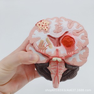 Modèle d'enseignement simulé de l'anatomie du cerveau ; outil pédagogique pour l'enseignement de l'anatomie pathologique du cerveau humain ; modèle des voies vasculaires et de la structure cérébrales - Product Image 5