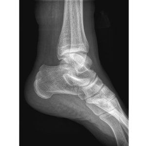 Detector de panel plano de rayos X <span class=keywords><strong>digital</strong></span> de alta resolución para imágenes médicas y <span class=keywords><strong>NDT</strong></span> - Product Image 6