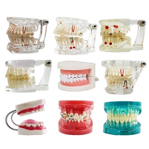 แบบจำลองฟันโปร่งใสสำหรับโรคต่างๆ แบบจำลองฟันปลอมใสสำหรับการฝึกหัดทางทันตกรรม แบบจำลองฟันมาตรฐานสำหรับการฝึกทันตแพทย์ แบบจำลองฟันที่ถอดออกได้สำหรับการศึกษาโรคทางทันตกรรม - Product Image 6