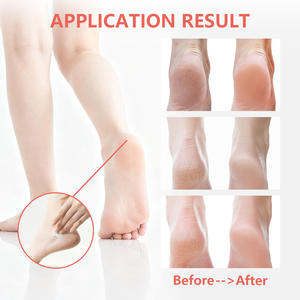 <span class=keywords><strong>Crema</strong></span> para <span class=keywords><strong>Pies</strong></span> con Urea de Marca Privada para Revitalizar la Piel Seca y Áspera de los <span class=keywords><strong>Pies</strong></span>, Hidratación Profunda y Curación de Grietas - Product Image 3