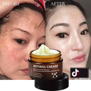 Etiqueta privada, crema para pecas, eliminación de arrugas, <span class=keywords><strong>manchas</strong></span> oscuras, blanqueamiento fuerte, colágeno, <span class=keywords><strong>Retinol</strong></span>, vitamina C, crema facial - Product Image 2