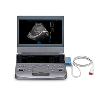 Échographe portable avec écran haute résolution de 15,6 pouces, 128 canaux physiques, sonde linéaire pour les examens vasculaires