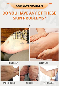 كريم تنحيف سريع المفعول من OTVENA-يحرق الدهون في 10 دقائق ، ويشرك الجلد ويقلل علامات التمدد نتائج مرئية في 7 أيام - Product Image 2