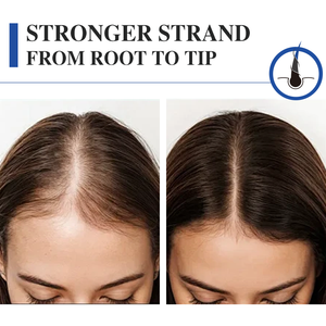 เซรั่มทองแดง L GHK-CU บำรุงเส้นผม/ดูแลการงอกใหม่ของเส้นผม ช่วยให้ผมแข็งแรง/หนา/ยาวขึ้น/ บำรุงหนังศีรษะ ป้องกันผมร่วง/<span class=keywords><strong>ลด</strong></span>การหลุดร่วงของเส้น<span class=keywords><strong>ผม</strong></span> - Product Image 5