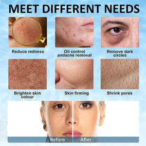 <span class=keywords><strong>Ice</strong></span> Con lăn BPA free cấp thực phẩm Silicone tái sử dụng bền màu sắc đẹp chất lượng mặt băng con lăn - Product Image 6