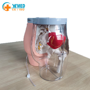 Modelo de Esqueleto de Glúteos para Entrenamiento de Inyección Intramuscular y Comparación, Modelo Transparente para Inyección en Glúteos, Modelo de Enfermería - Product Image 6