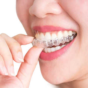 OEM su logotipo sin soportes tirantes alineadores invisibles sonrisa segura para aparatos dentales fáciles de limpiar alineador transparente - Product Image 3