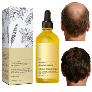Custom 100% Natural Organic Rosemary Hair <strong>Scalp</strong> Care Treatment Regrowth Biotin Rosemary Essential <strong>Oil</strong> Growth <strong>Oil</strong> Serum - Product Image 1