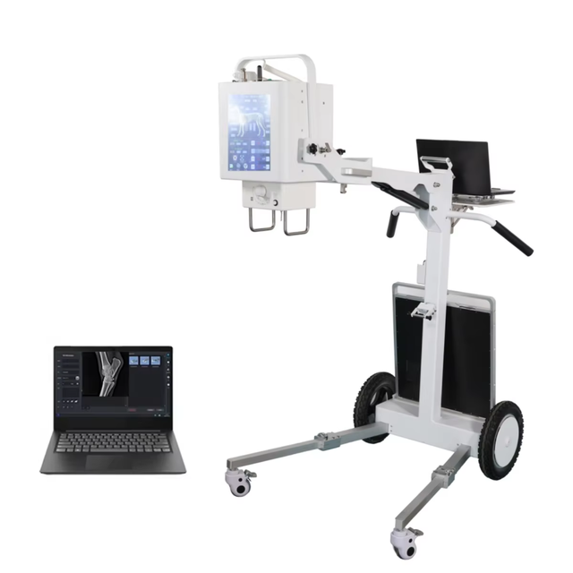 High Frequency Radiography 100MA Xray System Medical Diagnostic X-ray Equipment Mobile X Ray Machine Price With DR