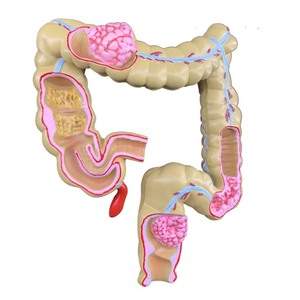 Modello Anatomico del Retto e del Canale Anale per Studio Patologico Umano - Product Image 6