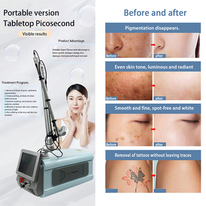 Nouveau prix de gros – 6 têtes optionnelles – Laser picoseconde pour l'élimination des tatouages avec têtes non invasives - Product Image 2