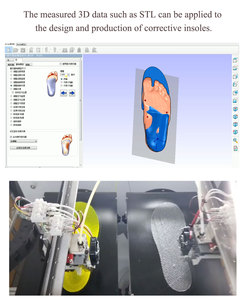 Escáneres de plantillas personalizadas, dispositivo escáner de pies planos, máquina escáner de pies, precio de fábrica, 3D personalizado - Product Image 5